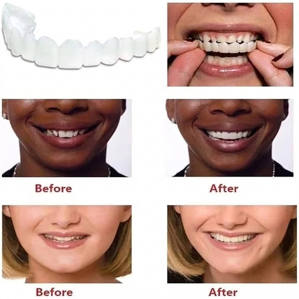 Snap On Veneers, Natural Looking Veneers for Upper and Lower Teeth, Instant Smile Makeover