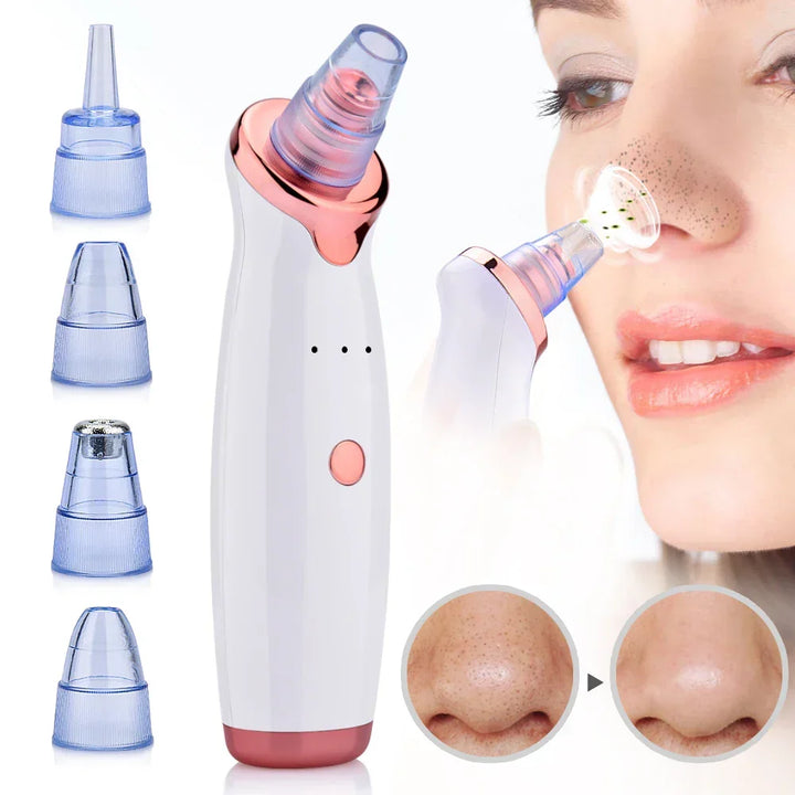 Electric Pore Vacuum Tool with Controlled Suction and Rechargeable Cable for Blackhead Extraction