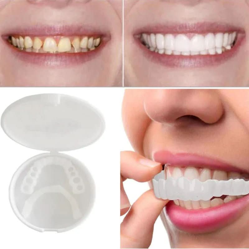 Snap-On Tooth Cover with Heat-Moldable Design and Reusable Use