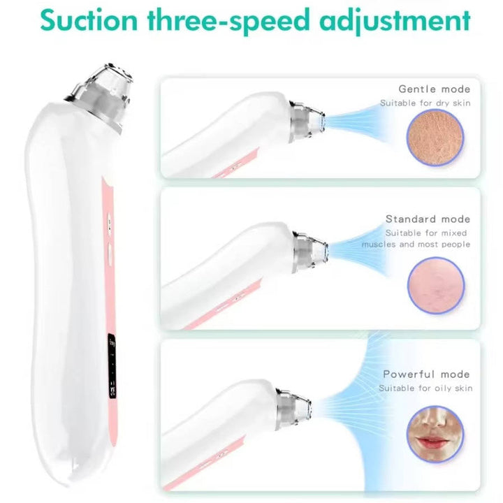 Blackhead Remover Vacuum with Camera, USB Interface Type Pore Vacuum, Black Head Extractions Tool