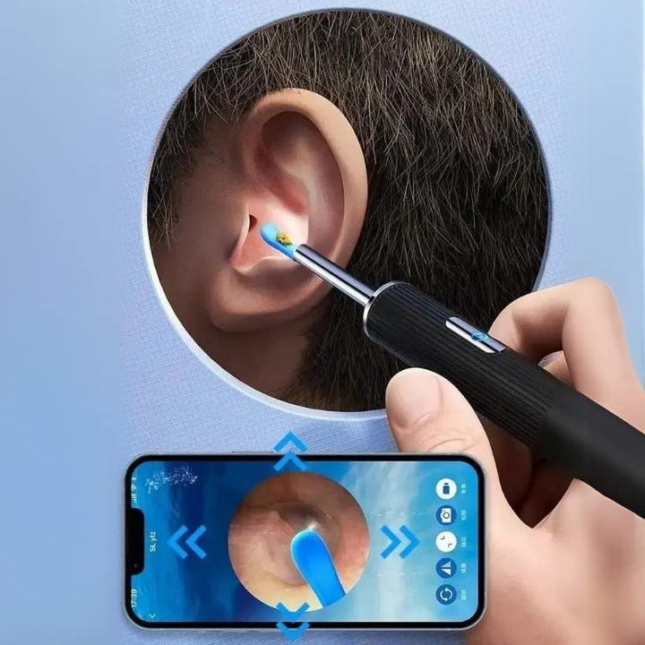 Ear Wax Removal Camera with LED Illumination and Rechargeable Handle, Wireless Viewing