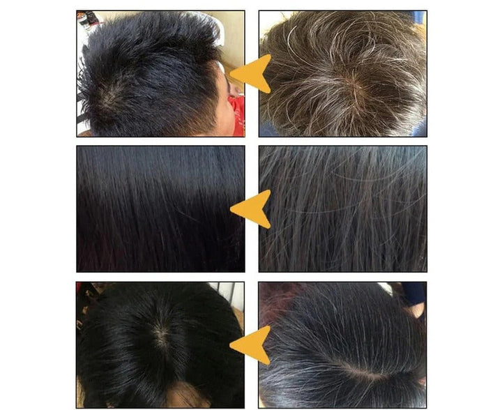 Anti grey Hair Shampoo Treatment