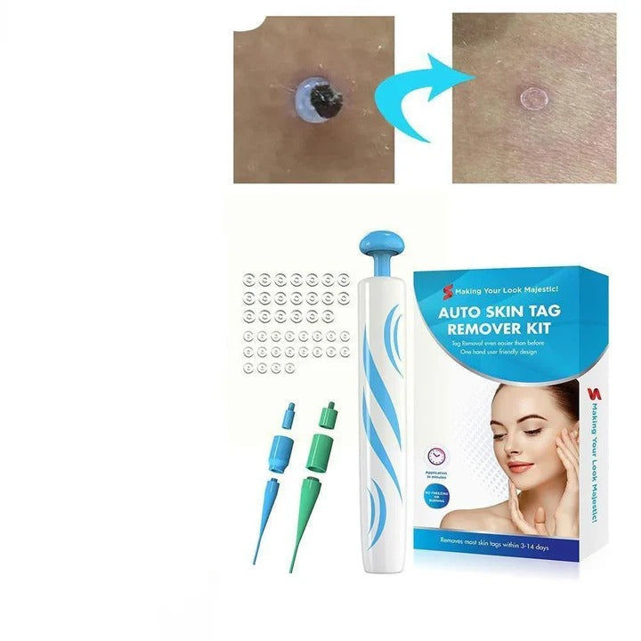 Skin Tag Care Kit for Personal Use
