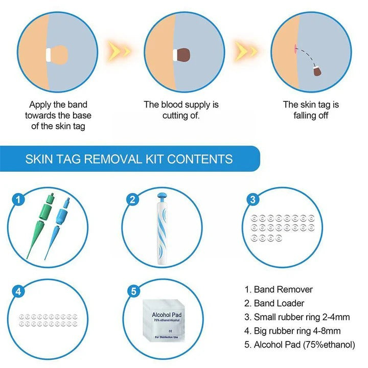 Skin Tag Care Kit for Personal Use