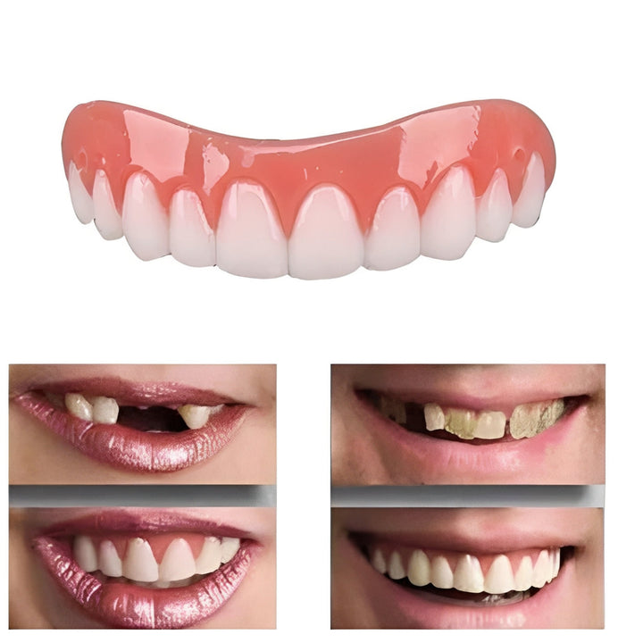 Snap On Artificial Teeth Cover with Customizable Fit and Storage Case
