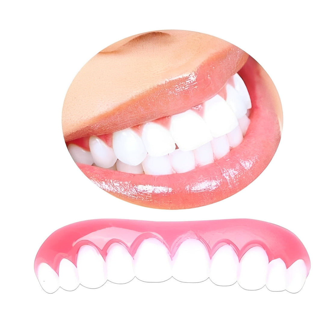 Snap On Artificial Teeth Cover with Customizable Fit and Storage Case