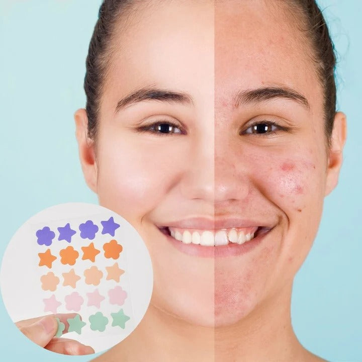 Acne Patch Stickers with Hydrocolloid Material