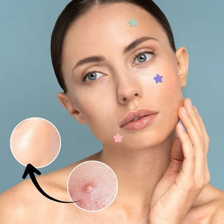 Acne Patch Stickers with Hydrocolloid Material