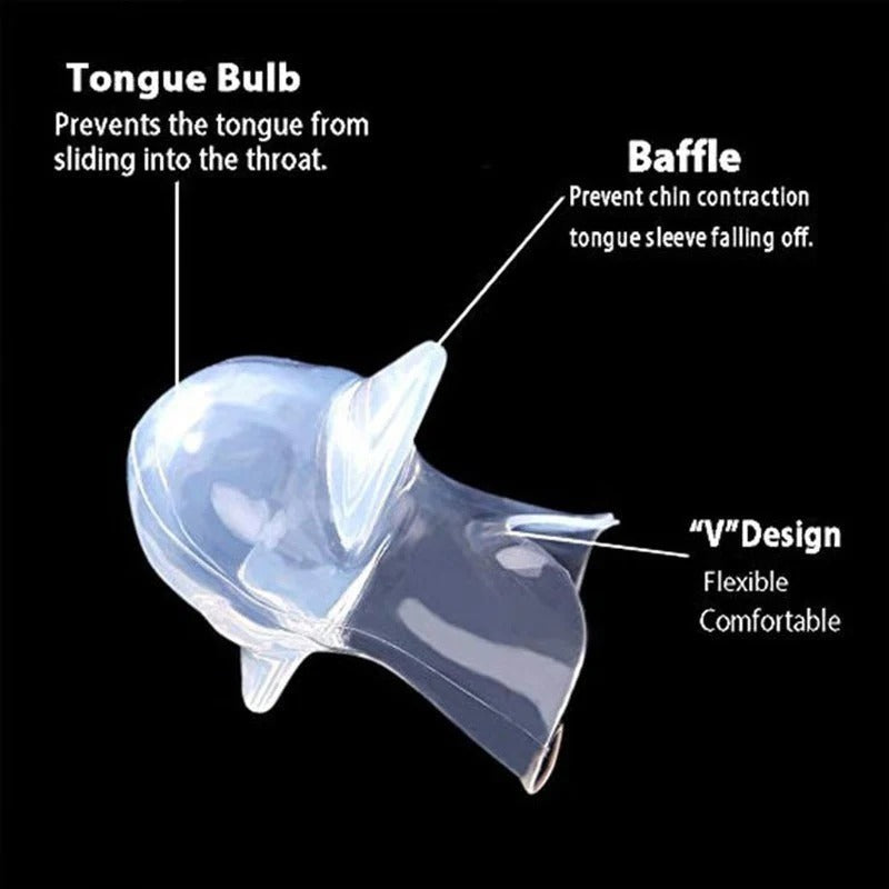 Mandibular Advancement Sleep Guard with Tongue Retaining Channel for Airway Openness