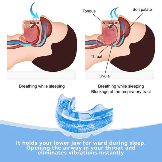 Adjustable Anti Snore Mouthpiece