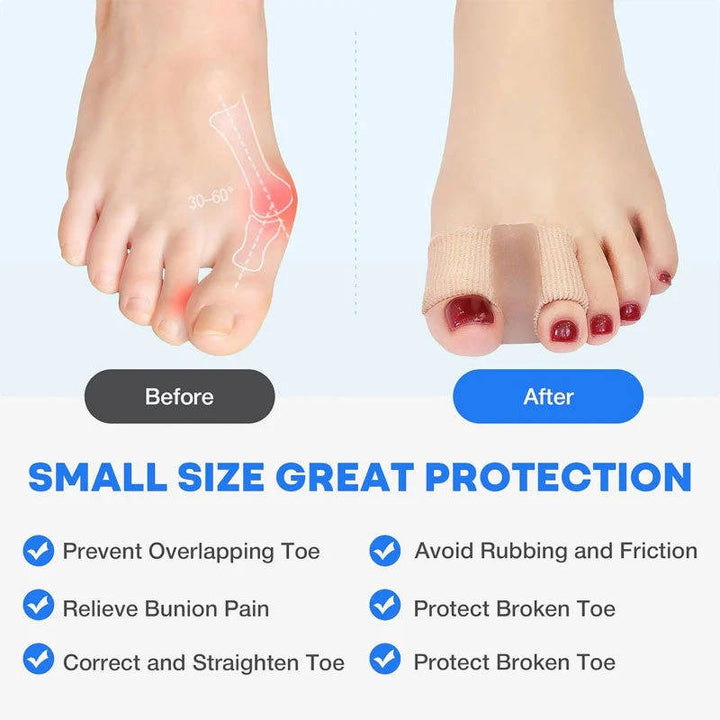 Toe Separator and Bunion Corrector